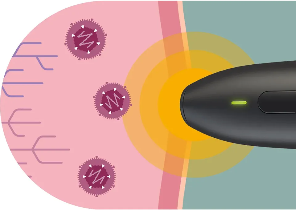 herpotherm neo – Schaubild physikalisches Wirkprinzip